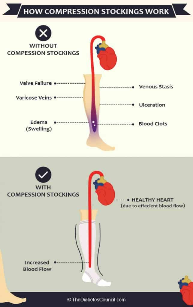 Everything You Need to Know About Diabetic Socks