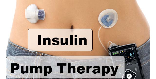 insulin pump therapy