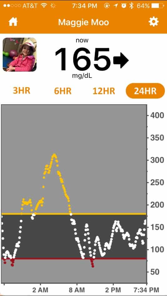 Dexcom Arrow Chart