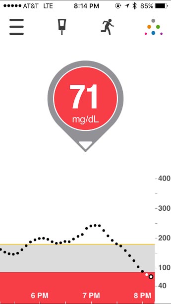 Dexcom Arrow Chart