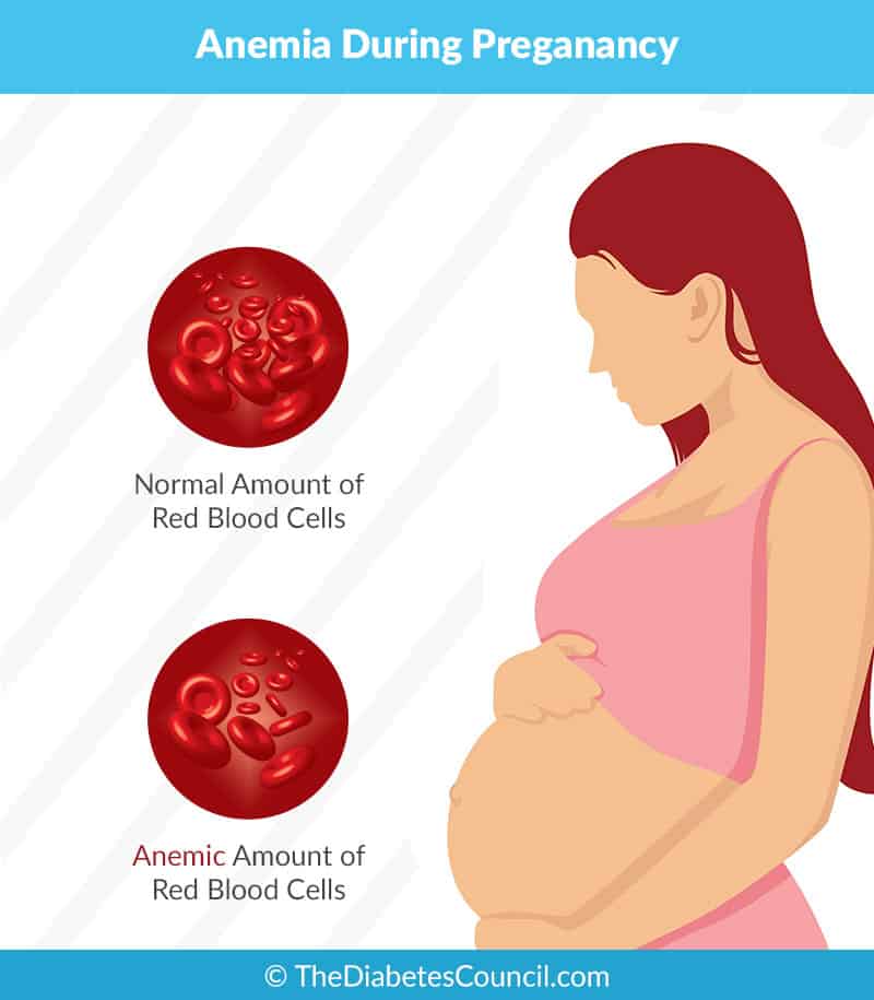 Iron Deficiency Anemia In Pregnant Women 65
