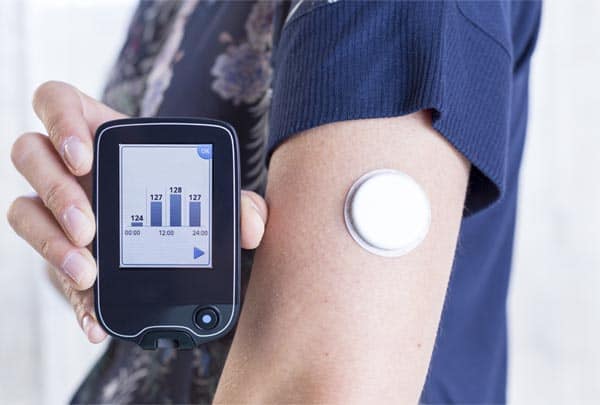 Continuous Glucose Monitoring