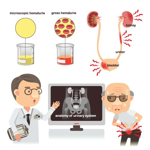 when to test urine for diabetes