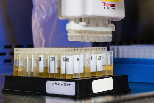 Ketone in Urine